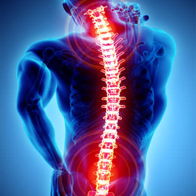 Chiropractic Treatment of MidBack (Thoracic) Pain - Advanced